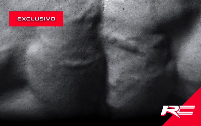 Dudas sobre el Acido Alfa Lipoico