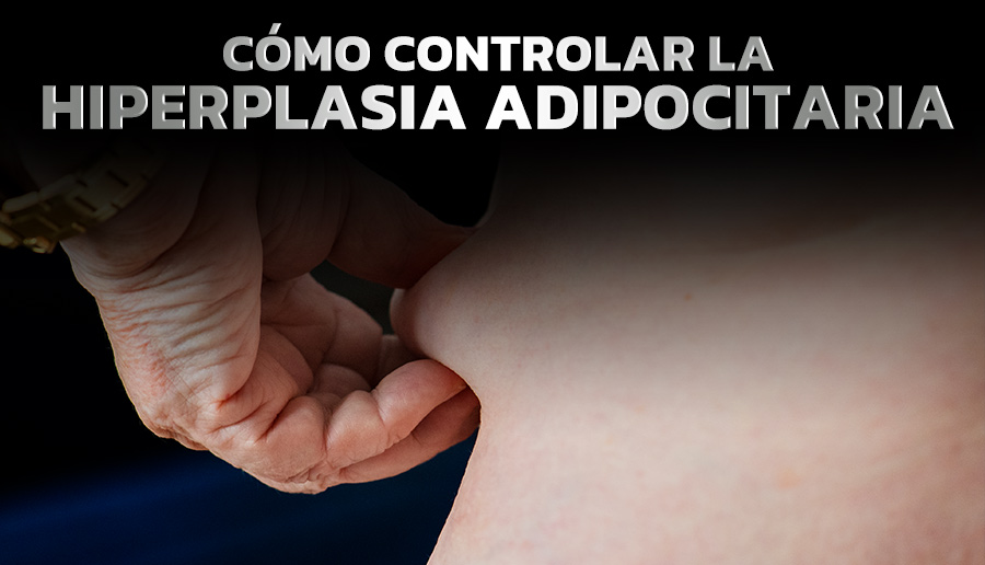 ¡No engordes mas! Cómo controlar la hiperplasia adipocitaria