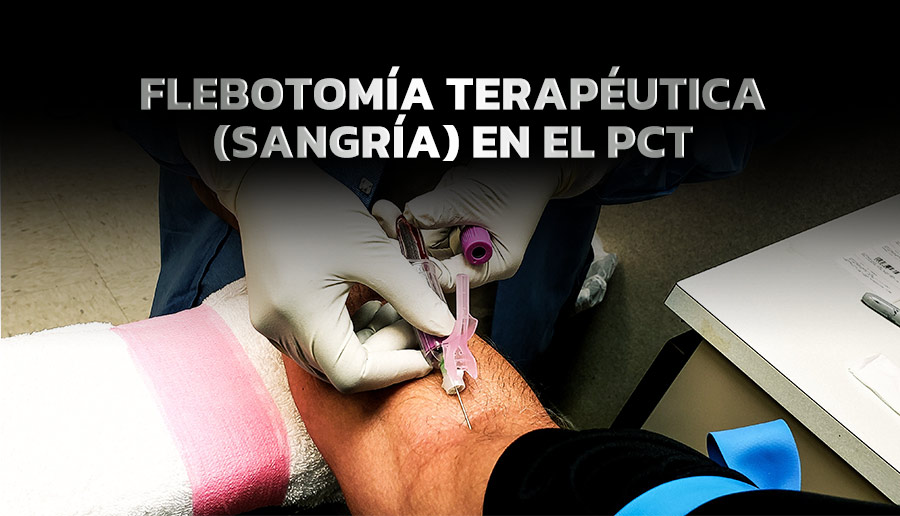 Flebotomía terapéutica (sangría) en el PCT